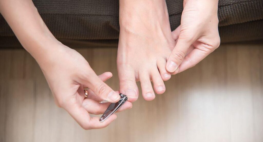 Trim your nails regularly.