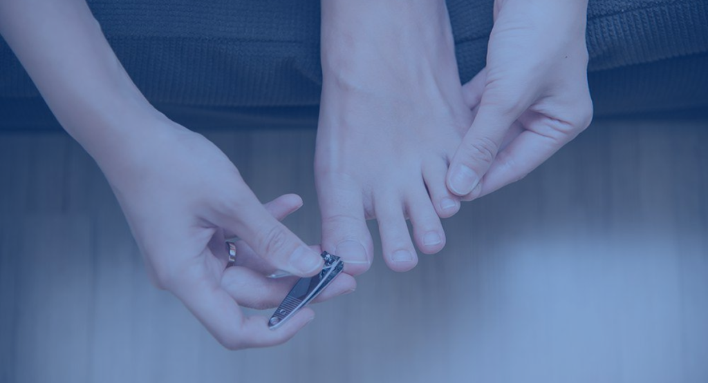 How to" Prevent Toenail Fungus Naturally