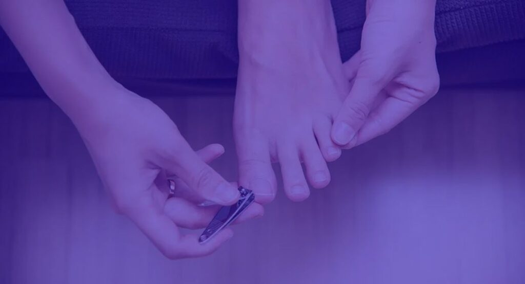 " Prevent Toenail Fungus Naturally."7 Proven Tips: