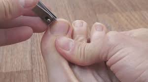 Regular nails trimming is a plus point.